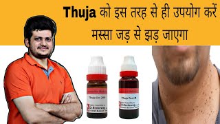 Thuja इस तरह से उपयोग करें मस्सा जड़ से झड़ जाएगा  Warts  Homeopathic Medicine  How to use [upl. by Ahtnahc]