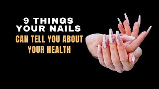 9 Things Your Nails Can Tell You About Your Health [upl. by Rawley]