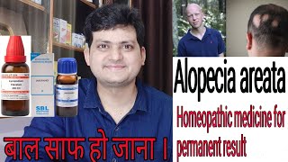 Homeopathic medicine for Alopecia areata  explain everything  permanent result [upl. by Orms]