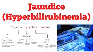 Hyperbilirubinemia  Jaundice  Biochemistry [upl. by Norel]