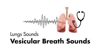 Vesicular Breath Sounds  Normal Lung Sounds  MEDZCOOL [upl. by Raddy]