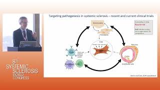 Breaking ground Exploring the latest frontiers in Systemic Sclerosis Research and closing session [upl. by Ggerg]