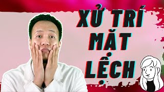 Cách để có mặt V line  xử trí mặt lệch đơn giản tự làm tại nhà  Dr Hiếu [upl. by Morel90]