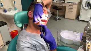 Self Extraction Wisdom Tooth 18 [upl. by Buffo]