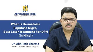 What Is Dermatosis Papulosa Nigra Best Laser Treatment For DPN In Hindi [upl. by Cumings80]