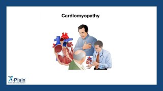 Cardiomyopathy [upl. by Edmondo]