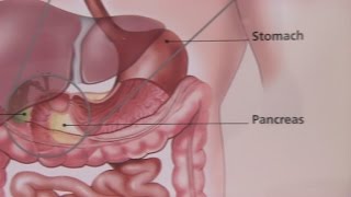 Irritable Bowel Syndrome amp Its Symptoms [upl. by Loralie]