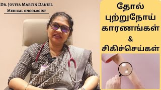 Melanoma Cancer in tamil  Causes  Symptoms Treatment  Dr Jovita Martin Daniel [upl. by Eenehs36]