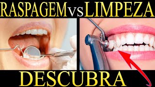 Saiba a DIFERENÇA entre LIMPEZA e RASPAGEM PERIODONTAL 1 [upl. by Nelyak]