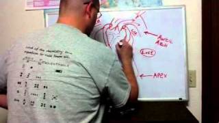 ECG Manifestations of ACS II [upl. by Ade]