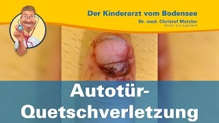 AutotürQuetschverletzung  Der Kinderarzt vom Bodensee [upl. by Anerbes]