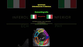 Ecocardiografia  Ipocinesia Inferolaterale E Inferiore [upl. by Zulch670]