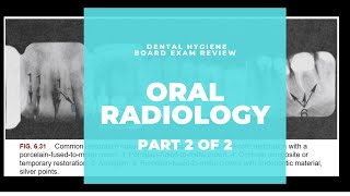 NBDHE  DENTAL HYGIENE BOARD EXAM REVIEW Everything you need to know about RadiographyPart 2 of 2 [upl. by Netsud]