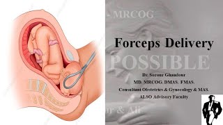 Teaching Forceps Delivery [upl. by Llet762]