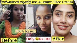 💯Result Best skin Brightening Cream 🧴❌No Side Effects 😎glamyganga [upl. by Villiers]