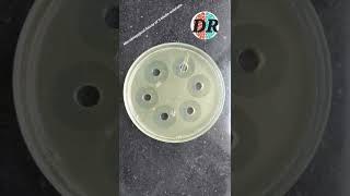 Microbiological Assay of Antibiotics [upl. by Jarrow]