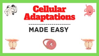 Cellular Adaptation Cell Adaptation Hypertrophy Atrophy Hyperplasia Metaplasia Pathology [upl. by Thadeus]