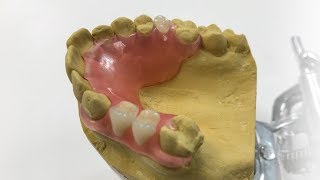 How To Make A Fiber Flex™ Partial  The Entire Process  Dental Lab Learning [upl. by Ripp221]