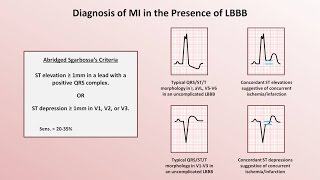 Intro to EKG Interpretation  Myocardial Infarctions Part 2 of 2 [upl. by Aerbas791]