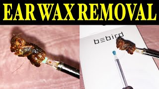 Easy Home Remedies For Removing Ear Wax  Watch Now [upl. by Walls]