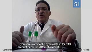 Video on Practical Analysis of Synovial Fluid [upl. by Akaenahs]