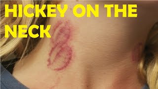 learn how to give someone a hickey on the neck [upl. by Oballa]