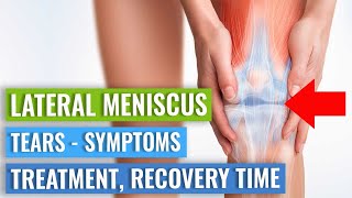 LATERAL Meniscus Tears Symptoms Treatment Surgery vs Exercise amp Recovery Time [upl. by Chernow]