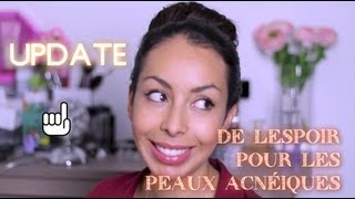 Update Routine Visage suite de ma lutte contre lacné [upl. by Furiya]