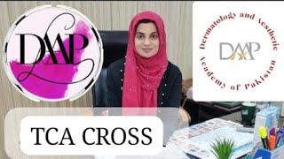 TCA CROSS Acne Scars Treatment by Dr Sadia Cheema Dermatologist  DAAP Aesthetics [upl. by Natan]