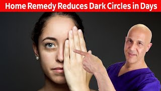 Home Remedy Reduces Dark Eye CirclesResults in Days Dr Mandell [upl. by Onfroi411]