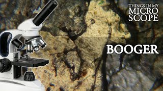 BOOGER UNDER MICROSCOPE  100X 250X 4K [upl. by Sesom]