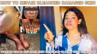 HOW TO REPAIR BLEACHED SKIN What To Use After Skin Bleaching To Make Your Skin Glow  Home Remedies [upl. by Manheim]