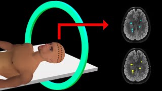 PET Scan  How It Works  Animation [upl. by Anastos312]