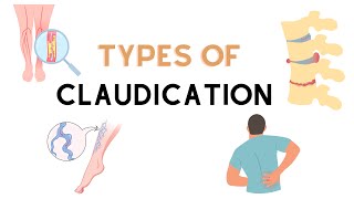 Types Of Claudication [upl. by Cadmarr854]