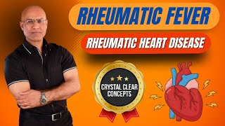 Rheumatic Fever Pathophysiology  Rheumatic Heart Disease [upl. by Aelgna]