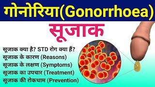 सूजाक रोग  Gonorrhea Causes Symptoms Diagnosis Treatment  Gonorrhea disease  sujak rog  STD [upl. by Gorski]