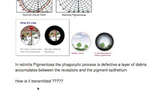 Retinitis Pigmentosa [upl. by Narag]