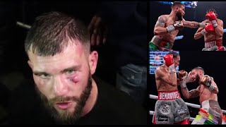 Caleb Plant Immediate Reaction from HOSPITAL to David Benavidez LOSS “No Excuses …” [upl. by Kehsihba]