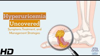 Hyperuricemia Understanding Its Signs Effects amp Management Essentials [upl. by Zertnom875]