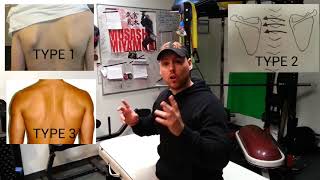 Shoulder Impingement Test  EASY SELFASSESSMENT [upl. by Nnyluqcaj]