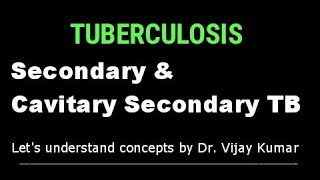 Secondary Pulmonary TB  Pulmonary TB  Secondary TB  Tuberculous Infection  Pathology Lectures [upl. by Hardy]