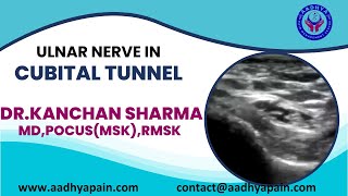 Ultrasound of the Ulnar Nerve in the Cubital Tunnel and its Dynamic Examination [upl. by Oludoet]