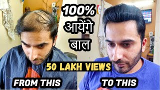 How to cure baldnessGanjepan in male  100 आयेंगे बाल  Hair Patch Solution  Born Creator [upl. by Ylera]