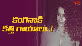 How Is Kangana Ranaut Injured On Manikarnika Sets  FilmGossips [upl. by Annabela]