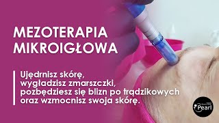 Mezoterapia mikroigłowa  najlepszy zabieg odmładzający [upl. by Liarret70]