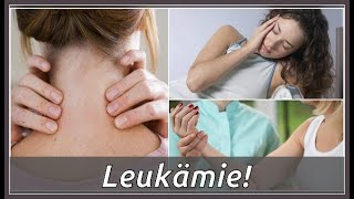 Das sind Symptome von Leukämie [upl. by Leroy92]