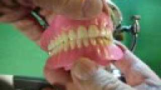 UL Dentures wax setup using a quotPrecision Coordinatorquot Ar [upl. by Anifad666]