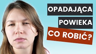 Opadająca POWIEKA  Zabiegi i Domowe Sposoby  Lekarz Wyjaśnia Co Zrobić Na Opadające Powieki [upl. by Florenza]