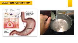 DIETA PARA HELICOBACTER PYLORI [upl. by Ettelegna]