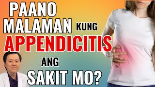 Paano Malaman Kung Appendicitis ang Sakit Mo  By Doc Willie Ong Internist and Cardiologist [upl. by Pantin555]